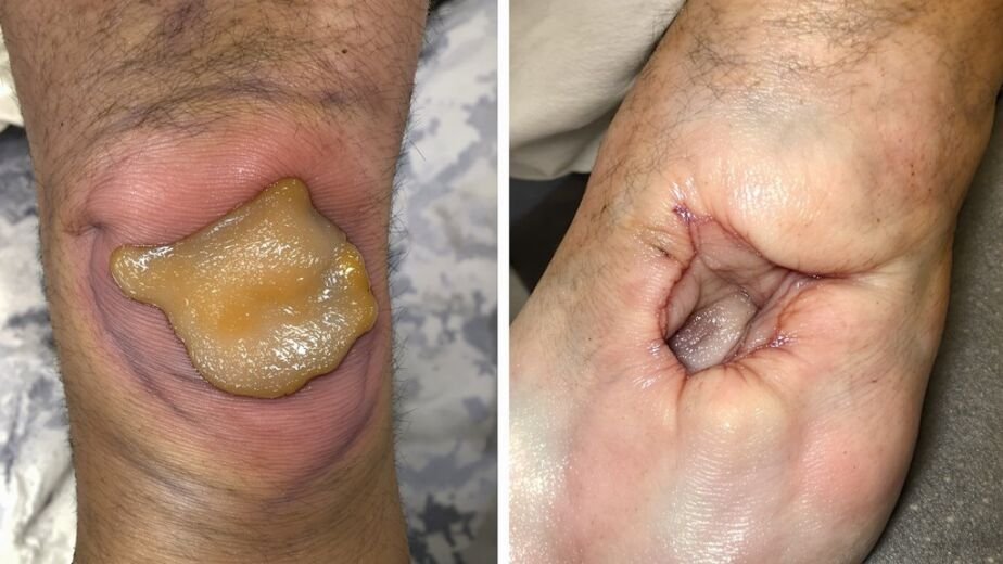 ulcer characteristics differentiation guide