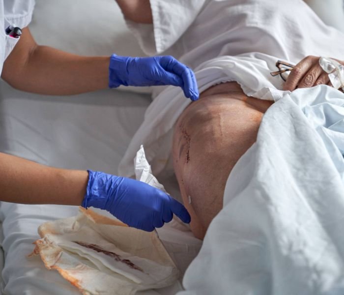 unrecognizable-nurse-applying-surgical-plaster